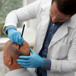The Ultimate Guide to Hair Transplants